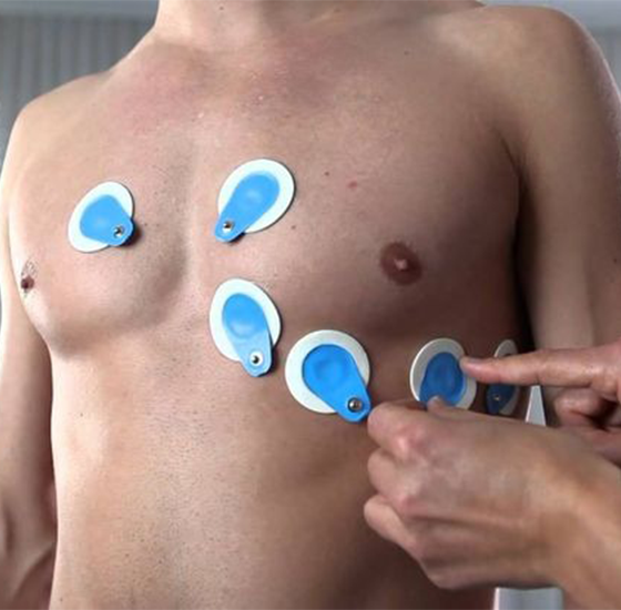 ECG Electrodes